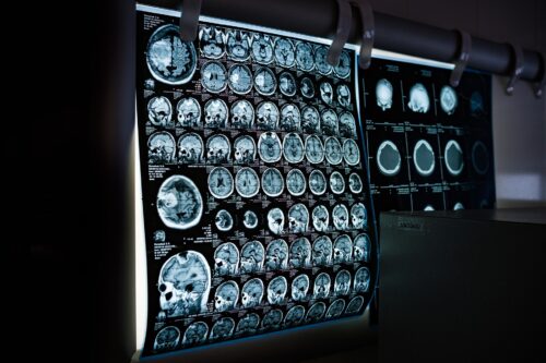 Surgical Simulation Market Research report 2025-2030, profiles of key players